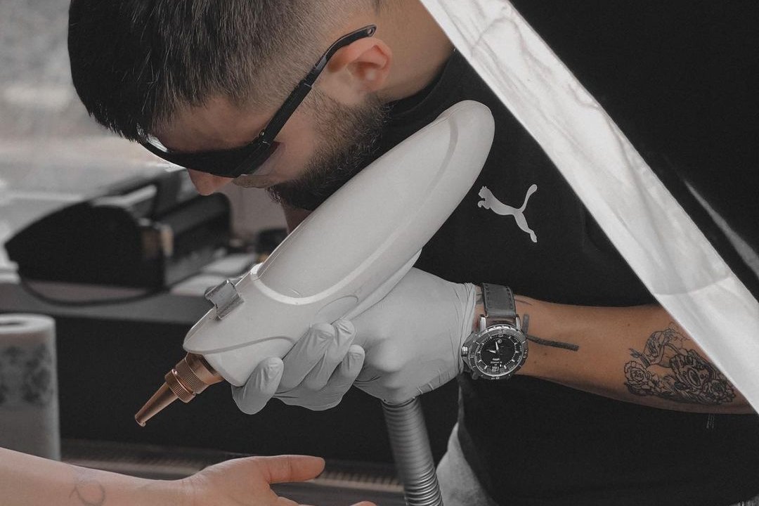 Eliminación de tatuajes en Alicante