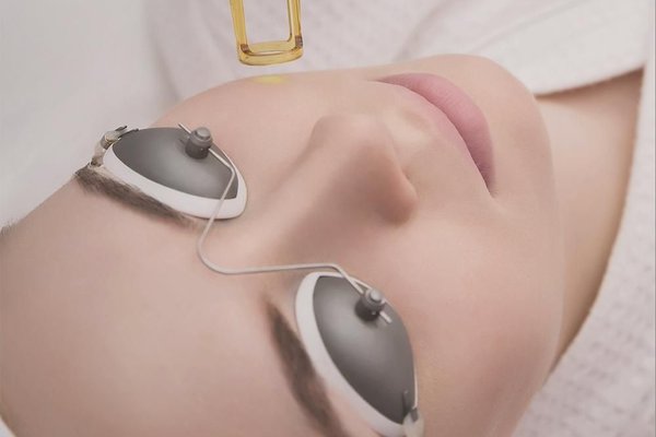 Cliente durante el procedimiento de eliminación de maquillaje permanente