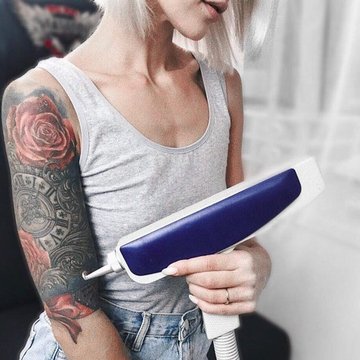 Eliminación de tatuajes
