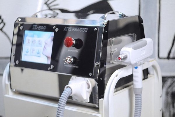 Tecnología láser avanzada para eliminar tatuajes