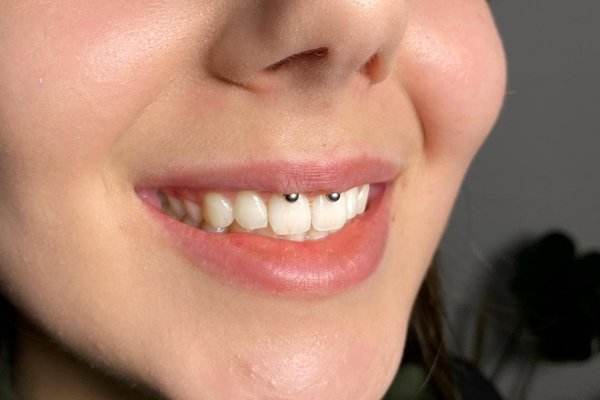 piercing smiley
