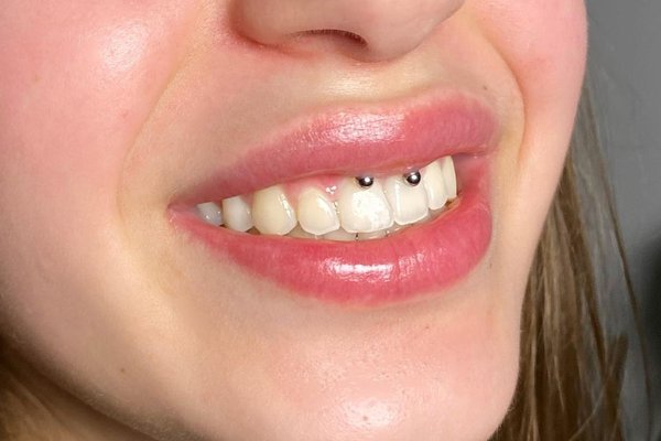 piercing smiley